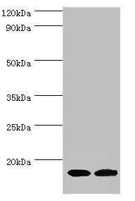 CPLX2 Antibody