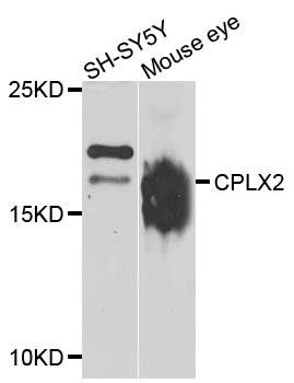 CPLX2 antibody