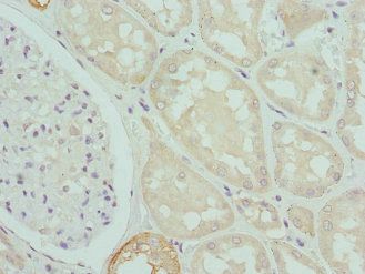 CPN1 Antibody