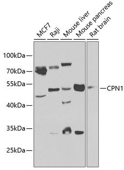 CPN1 antibody