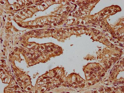 CPNE1 Antibody