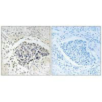 CPNE8 Antibody