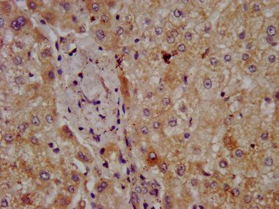 CPOX Antibody