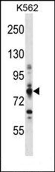 CPT1A antibody