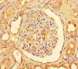 CPT1A Antibody