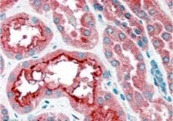 Goat anti-CPT1A Antibody