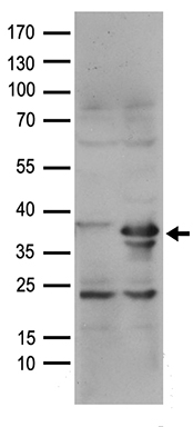 CPT1B antibody