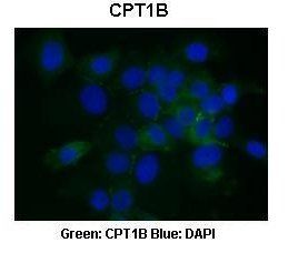 CPT1B antibody