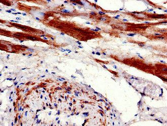 CPT1B Antibody
