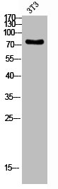 CPT1B Antibody