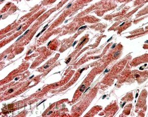 Goat anti-CPT1B (isoform 1) Antibody