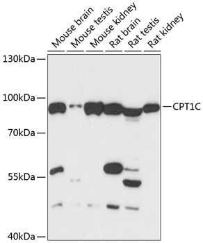 CPT1C antibody
