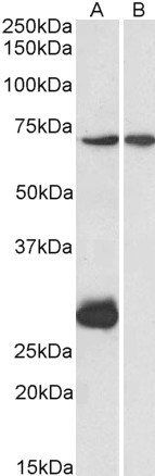 Goat anti-CPT2 (aa141-154) Antibody