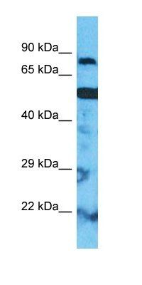 CPT2 antibody
