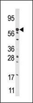 CPT2 antibody