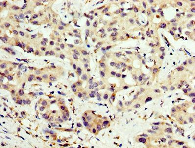 CPT2 Antibody