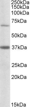 Goat anti-CPT2 (aa406-418) Antibody