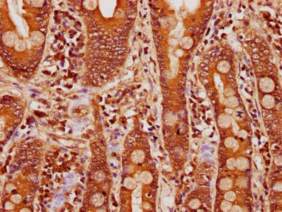 CPTP Antibody