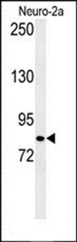 CQ028 antibody