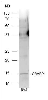 CRABP1 antibody