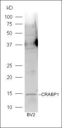 CRABP1 Rabbit Polyclonal Antibody
