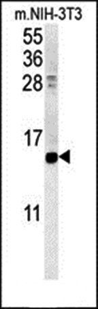 CRABP1 antibody