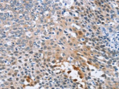 CRABP2 Antibody