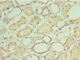 CRADD Antibody