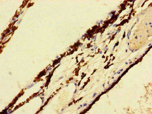 CRB2 antibody