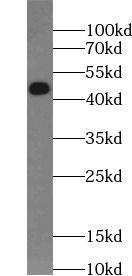 Creatine kinase B type-Specific antibody