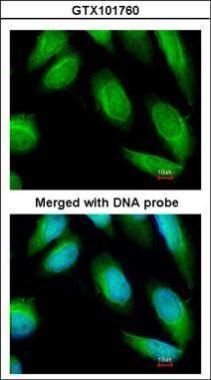 Creatine kinase (brain) antibody