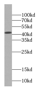 Creatine Kinase MM-Specific antibody