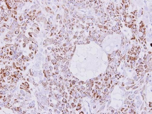 Creatine kinase MT antibody
