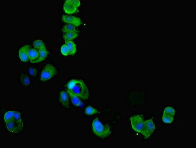 Creatine kinase U-type, mitochondrial antibody