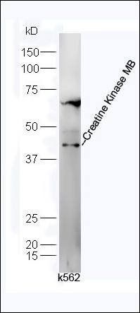 Creatine Kinase MB antibody