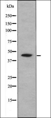 CREB (Phospho-Ser111) antibody