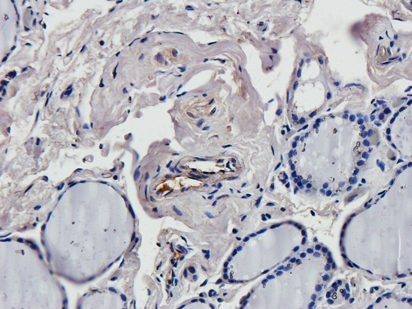 CREB3L3 antibody