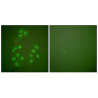 CREBBP Antibody