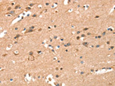 CRELD1 Antibody