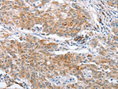 CRELD2 Antibody