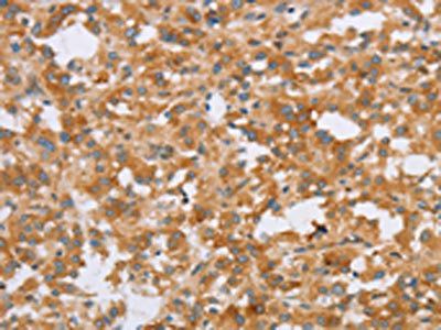 CRELD2 Antibody
