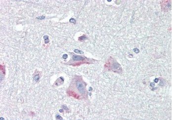 Goat anti-CRHR1 / CRF-R (aa 250 - 263) Antibody