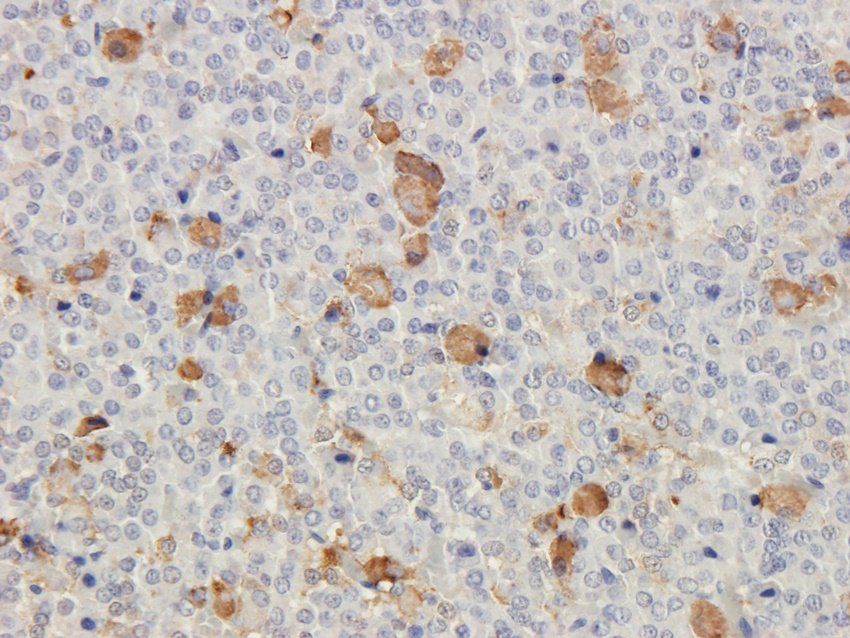 CRHR2 antibody