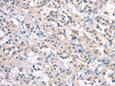 CRHR2 Antibody