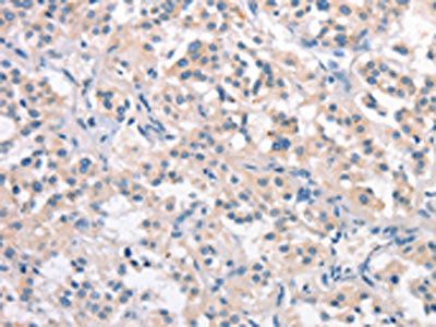 CRHR2 antibody