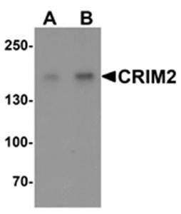 CRIM2 Antibody