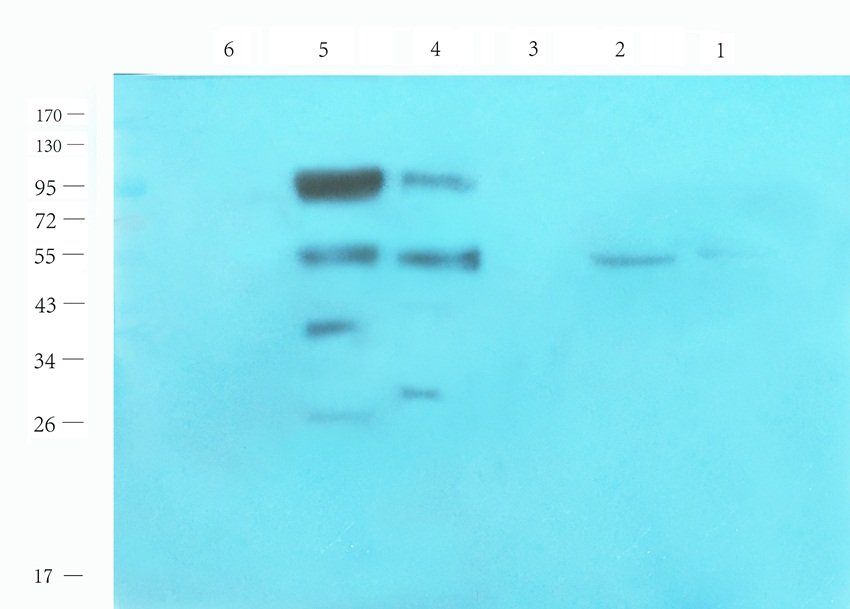 CRISP1 antibody