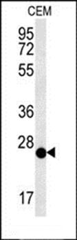 CRISPLD2 antibody