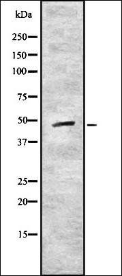 CRLF1 antibody