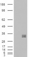 CRLF3 Antibody